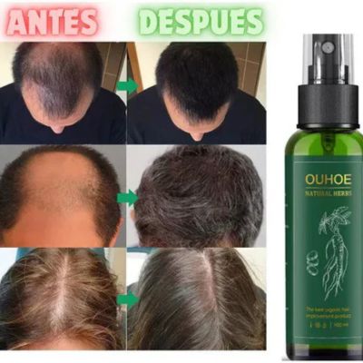 Activa el crecimiento desde la raíz con FollicX™